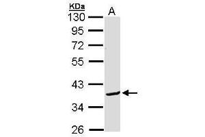 BCL2L12 antibody  (C-Term)