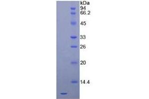 Image no. 1 for Chemokine (C-X-C Motif) Ligand 12 (CXCL12) ELISA Kit (ABIN6730881)
