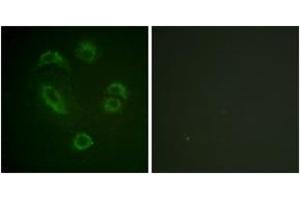 Immunofluorescence analysis of A549 cells, using DAPP1 (Phospho-Tyr139) Antibody.