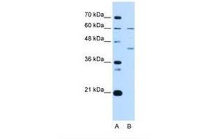 Image no. 2 for anti-Replication Factor C (Activator 1) 5, 36.5kDa (RFC5) (N-Term) antibody (ABIN6738219)