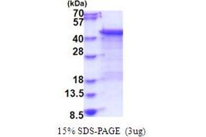 Image no. 1 for Dual Specificity Phosphatase 6 (DUSP6) (AA 1-381) protein (His tag) (ABIN6387465)