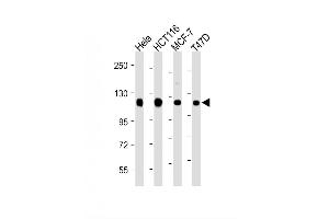 Image no. 2 for anti-Retinoblastoma Binding Protein 8 (RBBP8) (AA 763-792), (C-Term) antibody (ABIN657950)