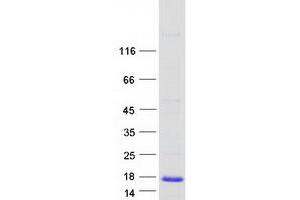 Image no. 1 for Microseminoprotein, Prostate Associated (MSMP) protein (Myc-DYKDDDDK Tag) (ABIN2725991)