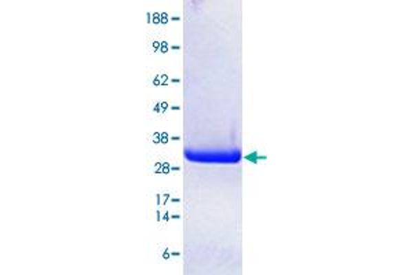 P21 Protein (Cdc42/Rac)-Activated Kinase 7 (PAK7) (AA 425-719) protein