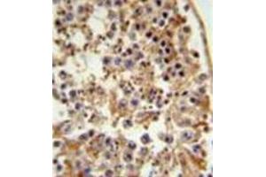 Image no. 1 for anti-Fanconi Anemia, Complementation Group C (FANCC) (AA 529-558), (C-Term) antibody (ABIN952264)