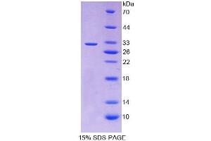 Image no. 1 for Retinoic Acid Receptor, beta (RARB) (AA 205-451) protein (His tag) (ABIN6237327)
