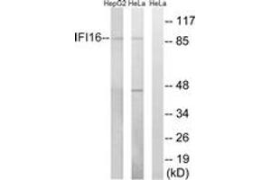 Image no. 1 for anti-Interferon, gamma-Inducible Protein 16 (IFI16) (AA 731-780) antibody (ABIN1534925)