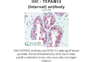 Image no. 1 for anti-Tetraspanin 13 (TSPAN13) (Internal Region) antibody (ABIN1740424)