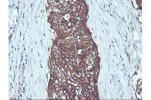 Image no. 1 for anti-V-Ral Simian Leukemia Viral Oncogene Homolog B (Ras Related, GTP Binding Protein) (Ralb) antibody (ABIN1500584)