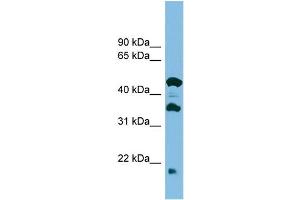 Image no. 1 for anti-Chromosome 11 Open Reading Frame 73 (C11orf73) (Middle Region) antibody (ABIN2786966)
