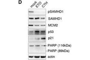 ETO regulates SAMHD1 phosphorylation through the p53, p21 pathwayMDM were treated with increasing concentrations of ETO and CTH.