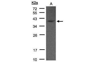 Image no. 1 for anti-Glycerol-3-Phosphate Dehydrogenase 1 (Soluble) (GPD1) (Center) antibody (ABIN2855730)