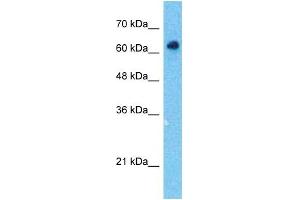 Image no. 5 for anti-SRY (Sex Determining Region Y)-Box 10 (SOX10) (Middle Region) antibody (ABIN2777864)