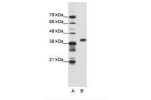 Image no. 1 for anti-Poly(rC) Binding Protein 1 (PCBP1) (AA 201-250) antibody (ABIN202334)