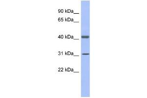 Image no. 1 for anti-Glyceraldehyde-3-Phosphate Dehydrogenase, Spermatogenic (GAPDHS) (N-Term) antibody (ABIN2778655)