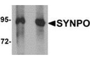 Image no. 3 for anti-Synaptopodin (SYNPO) (C-Term) antibody (ABIN783789)