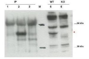 anti-Cytohesin 1 Interacting Protein (CYTIP) (C-Term) antibody