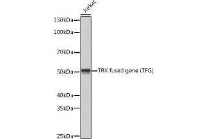 Western blot analysis of extracts of Jurkat cells, using TRK fused gene (TFG) (TFG) Rabbit mAb (ABIN1512690, ABIN3022090, ABIN3022091 and ABIN7101442) at 1:3000 dilution.