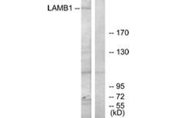 anti-Laminin, beta 1 (LAMB1) (AA 1721-1770) antibody