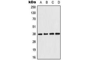 Image no. 3 for anti-Protein Kinase, AMP-Activated, beta 1 Non-Catalytic Subunit (PRKAB1) (N-Term) antibody (ABIN2707328)