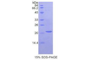 Image no. 1 for Cathepsin L1 (CTSL1) protein (ABIN1170046)