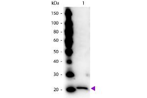 Image no. 1 for anti-Ferritin (FE) antibody (ABIN99122)