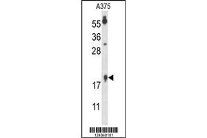 Western Blotting (WB) image for anti-Family with Sequence Similarity 96, Member B (FAM96B) antibody (ABIN2158794)