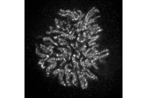 Image no. 2 for anti-Non-SMC Condensin II Complex, Subunit H2 (NCAPH2) antibody (ABIN6972410)