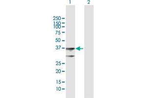 Image no. 1 for anti-3-hydroxybutyrate Dehydrogenase, Type 1 (BDH1) (AA 1-343) antibody (ABIN513697)