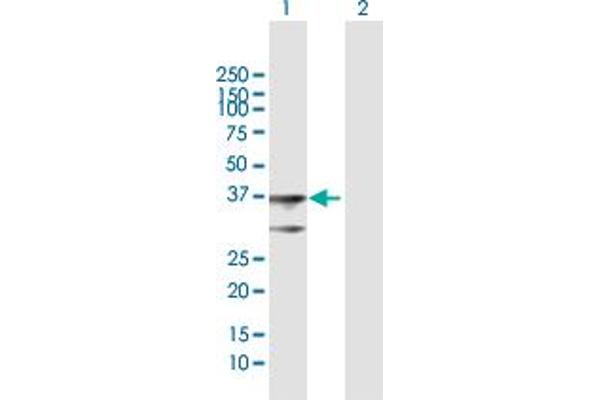 anti-3-hydroxybutyrate Dehydrogenase, Type 1 (BDH1) (AA 1-343) antibody