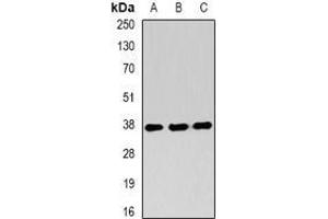 Image no. 1 for anti-Ring Finger Protein 2 (RNF2) (full length) antibody (ABIN6005194)