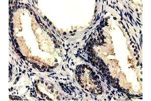 Immunohistochemical staining of paraffin-embedded Human prostate tissue using anti-CBWD1 mouse monoclonal antibody.