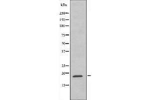 Image no. 1 for anti-Ribosomal Protein S11 (RPS11) (C-Term) antibody (ABIN6257640)