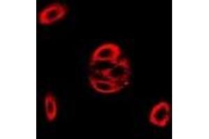 Immunofluorescent analysis of Fis1 staining in MCF7 cells.