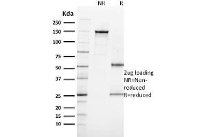Image no. 8 for anti-Antigen Identified By Monoclonal Antibody Ki-67 (MKI67) (AA 2293-2478) antibody (ABIN6940053)