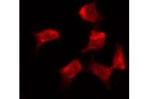 Image no. 3 for anti-Ezrin (EZR) (pTyr353) antibody (ABIN6256714)