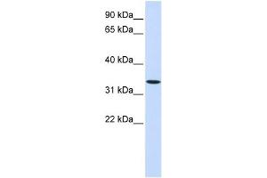 Image no. 1 for anti-Wingless-Type MMTV Integration Site Family, Member 6 (WNT6) (Middle Region) antibody (ABIN635755)