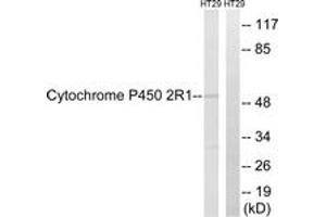 anti-Cytochrome P450, Family 2, Subfamily R, Polypeptide 1 (CYP2R1) (AA 251-300) antibody