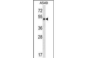 Image no. 2 for anti-Pancreatic Lipase (PNLIP) (AA 312-341), (C-Term) antibody (ABIN5531907)
