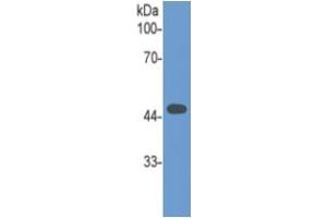 Mouse Capture antibody from the kit in WB with Positive Control: Human Spinal cord lysate.