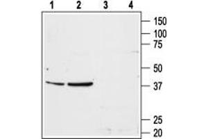 anti-Angiotensin II Receptor, Type 1 (AGTR1) (AA 4-18), (Extracellular), (N-Term) antibody