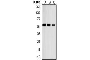 Image no. 2 for anti-Proteasome (Prosome, Macropain) 26S Subunit, Non-ATPase, 12 (PSMD12) (Center) antibody (ABIN2706887)