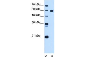 Image no. 1 for anti-T-Box 15 (TBX15) antibody (ABIN2463095)