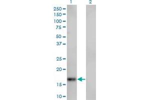 Image no. 2 for anti-Spire Homolog 1 (Drosophila) (SPIRE1) (AA 482-583) antibody (ABIN566050)