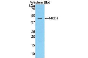 Image no. 1 for anti-Prolactin-Induced Protein (PIP) (AA 1-146) antibody (ABIN1860229)