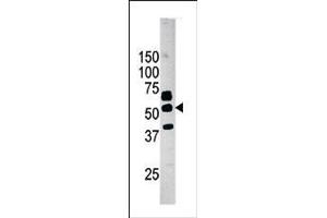 Image no. 1 for anti-Pantothenate Kinase 2 (PANK2) (AA 65-95), (N-Term) antibody (ABIN391237)