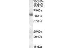 Image no. 2 for anti-Transmembrane Protease, serine 2 (TMPRSS2) (Internal Region) antibody (ABIN570926)