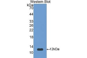 Image no. 1 for anti-serpin Peptidase Inhibitor, Clade A (Alpha-1 Antiproteinase, Antitrypsin), Member 12 (SERPINA12) (AA 52-143) antibody (ABIN1173450)