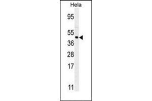 Image no. 2 for anti-Forkhead Box L2 (FOXL2) (AA 10-37), (N-Term) antibody (ABIN952375)
