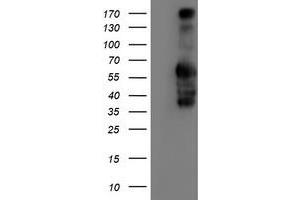 Image no. 10 for anti-Iduronate 2-Sulfatase (IDS) antibody (ABIN1498798)